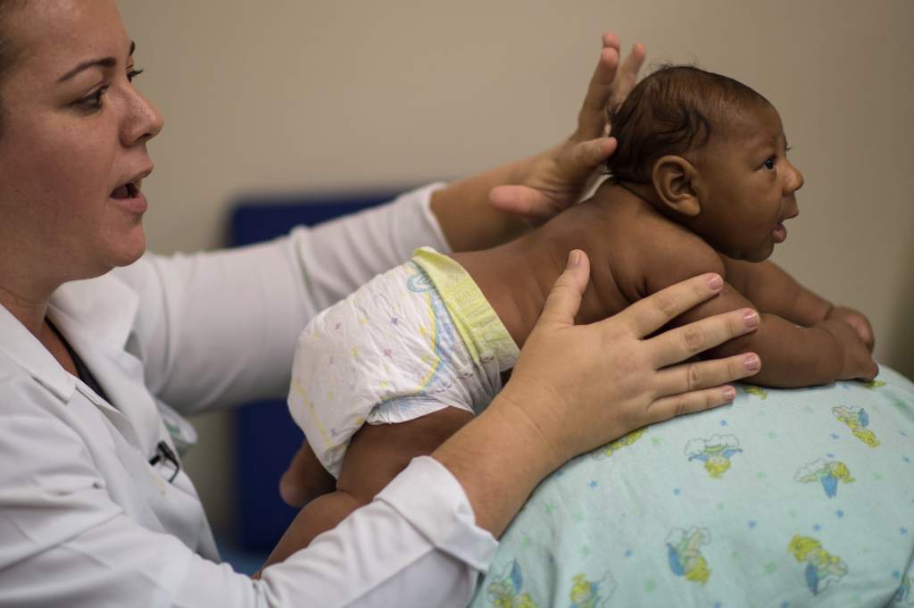 Cinco casos de bebés nacidos con microcefalia