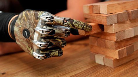 Protesis roboticas subsanar problemas fisicos LRZIMA20161222 0044 3