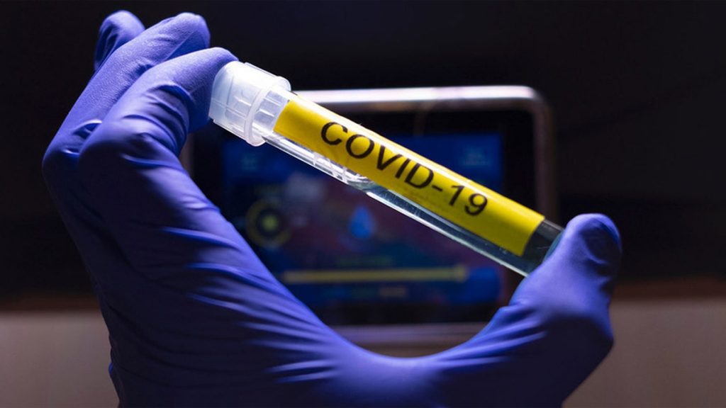 covid 19 01042020