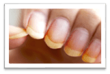 Aclaradores de uñas 2 image 5